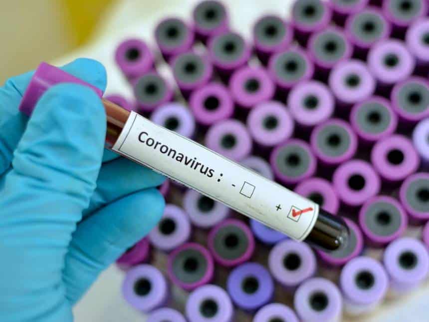 20200130035427_860_645_-_confirmacao_de_coronavirus Paciente com suspeita de coronavírus é instruído a voltar ao trabalho