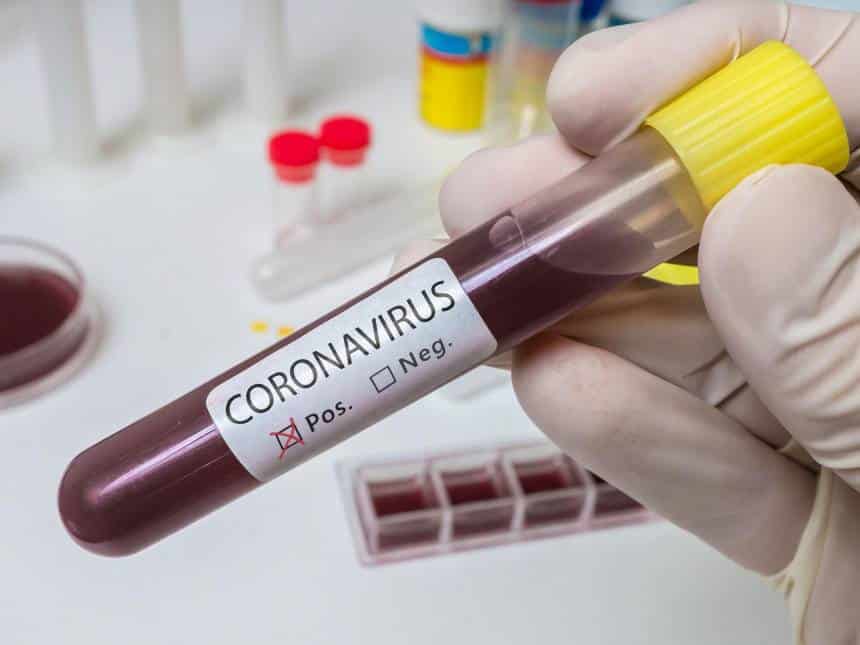 20200228070742_860_645_-_coronavirus Taxa de mortalidade da Covid-19 é de 3,4%