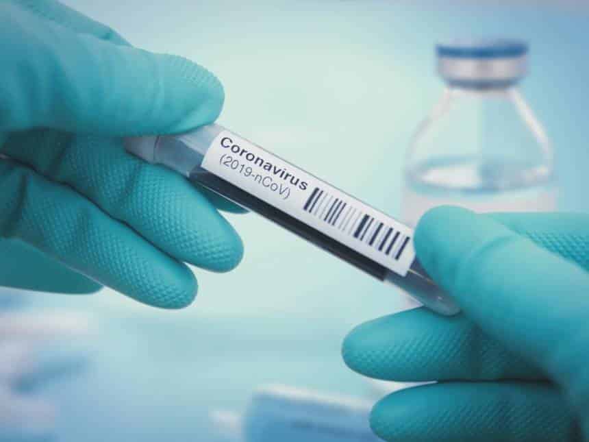 20200309121736_860_645_-_coronavirus Pesquisadores brasileiros cultivam coronavírus em laboratório
