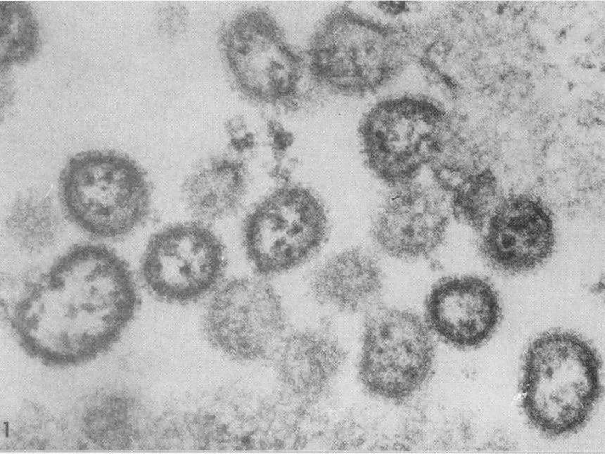 20201117111244_860_645_-_arenavirus Cientistas detectam transmissão entre humanos de vírus letal na Bolívia