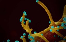 Covid-19: imagens microscópicas mostram ‘tentáculos’ em células infectadas
