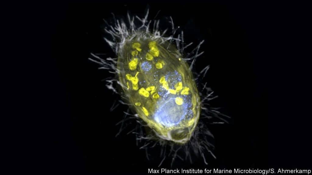 Imagem do microorganismo ciliado onde a "nova mitocôndria" foi descoberta