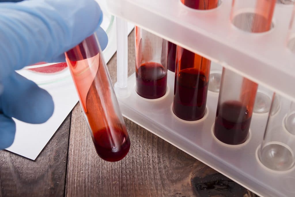 Frascos com amostras de sangue