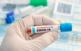 Covid-19: estudo mede nível de anticorpos produzidos pela vacina e infecção natural da doença