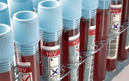 HIV: cientistas descobrem variante mais agressiva na Holanda