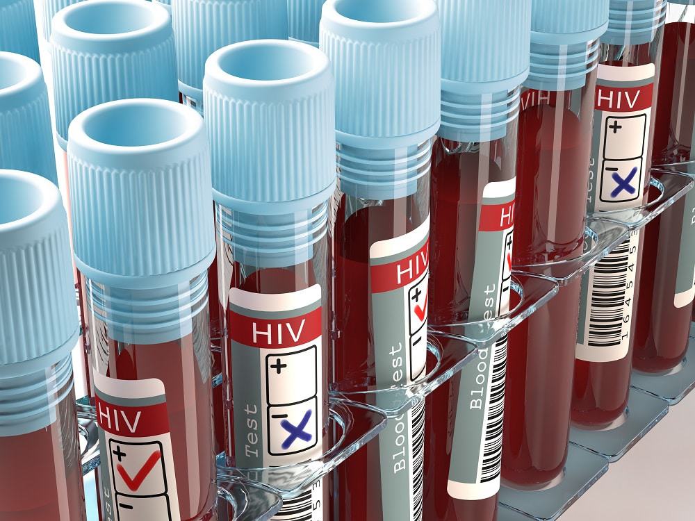 Imagem mostra ampolas de coleta de sangue, com etiquetas nas quais está escrito HIV