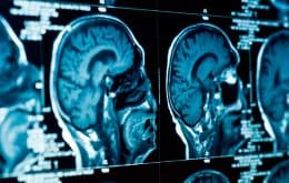 Trabalhador pode ter contraído doença cerebral mortal em laboratório