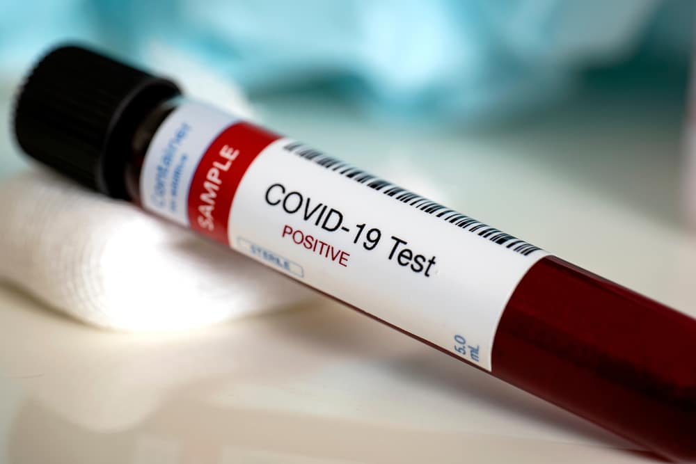 Imagem mostra uma amostra de sangue positivo para coronavírus