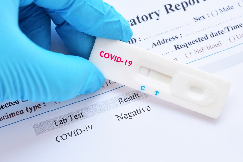 morcegos_covid Novo vírus da Covid pode ser resistente às vacinas