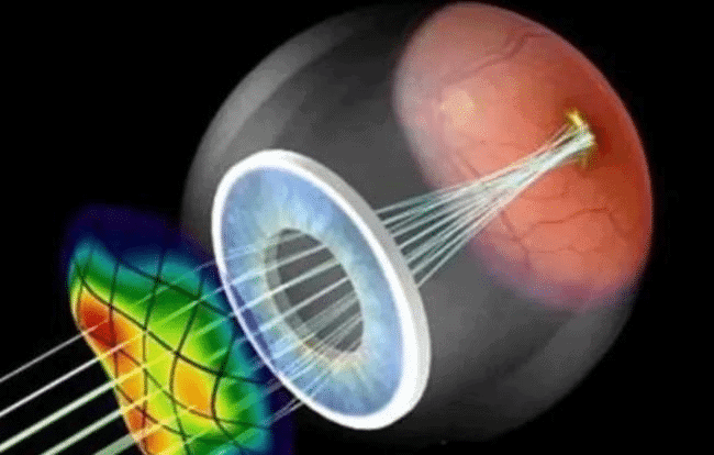 Mesma tecnologia desenvolvida para mapear os espelhos do James Webb utilizada na cirurgia ocular LASIK