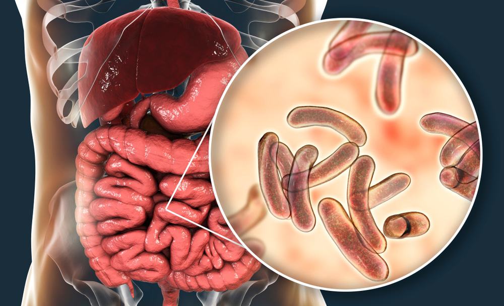 Ilustração da cólera no sistema digestivo