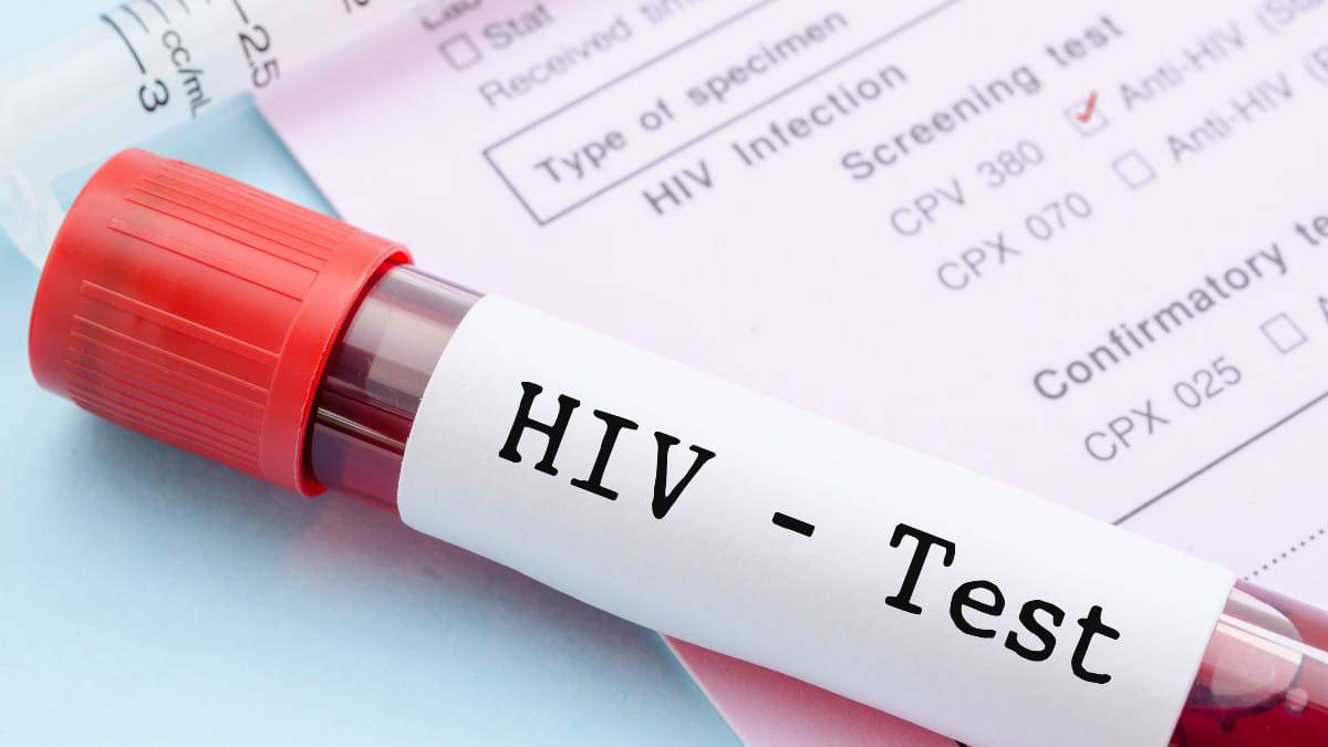 Tubo de teste de HIV