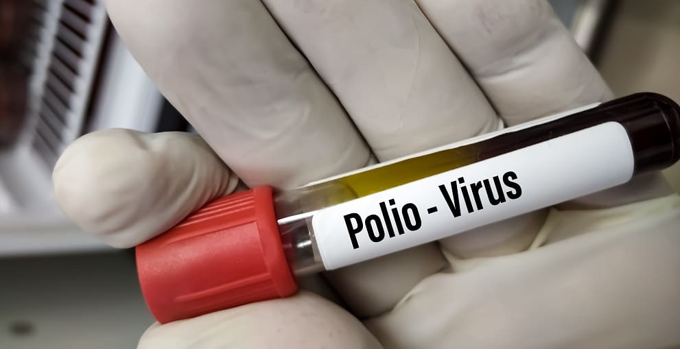 Análises detectaram vírus da pólio no esgoto de três municípios dos EUA. Imagem: Babul Hosen/shutterstock