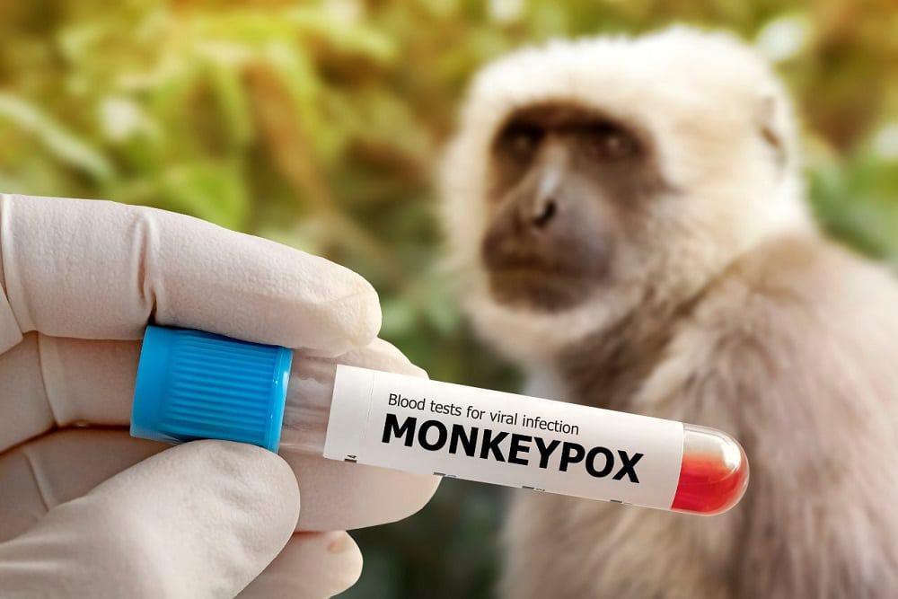Varíola dos macacos: Brasil registra primeiros casos com transmissão local