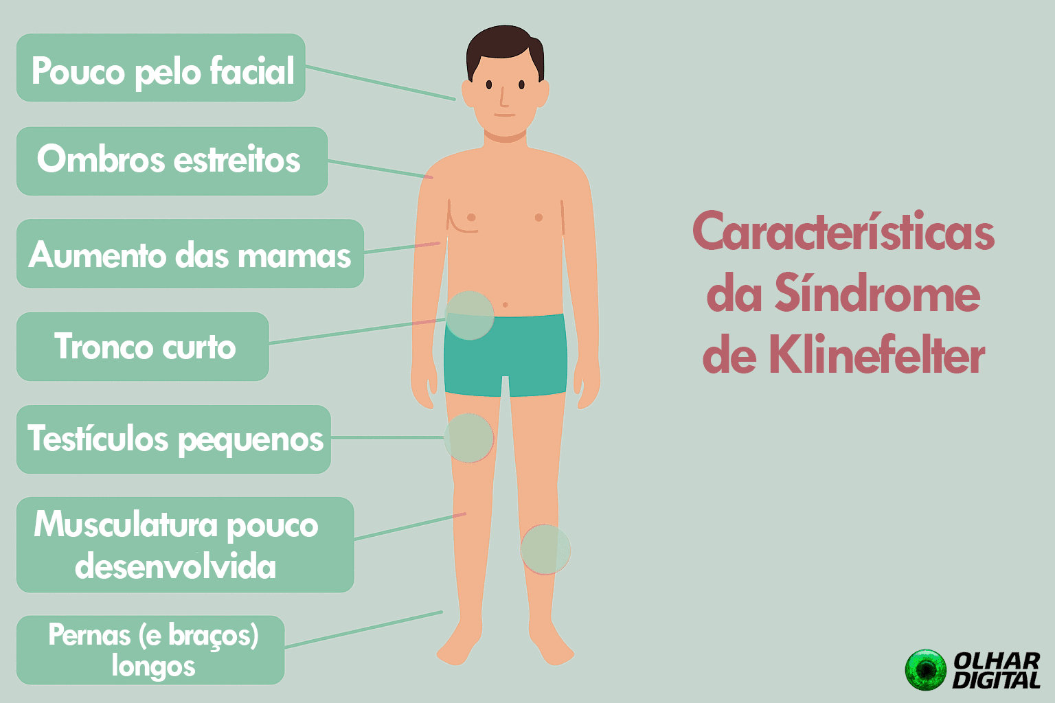 O que é a Síndrome de Klinefelter e como ela afeta os homens ...